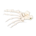 Dalinai sutvirtintas pėdos skeletas