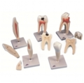 Klasikinės serijos dantų modeliai, 5 pavyzdžiai