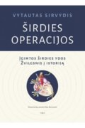 Širdies operacijos
