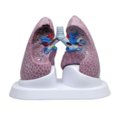 Plaučių modelis su patologijomis