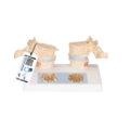 Osteoporozės didaktinis modelis